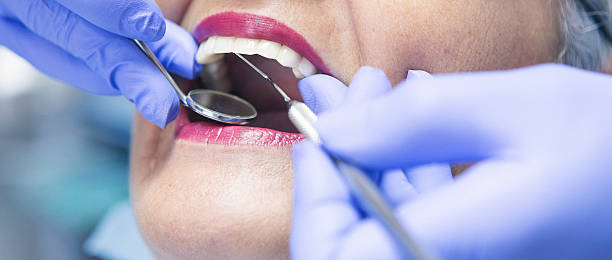 Best Teeth Whitening  in Alexandria, MN